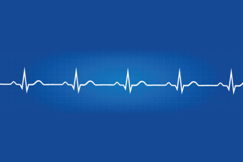 Electrocardiogram (EKG / ECG)